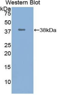 UCHL5 / UCH37 Antibody (aa2-316)