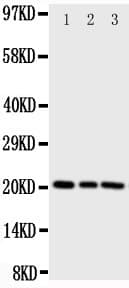 Polyclonal Rabbit anti-Mouse PEBP1 / RKIP Antibody (aa15-29, IHC, WB)