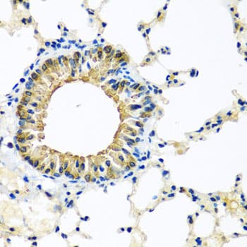 Polyclonal Rabbit anti-Human KCTD15 Antibody (IHC, WB)