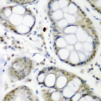 Polyclonal Rabbit anti-Human CDC27 Antibody (IHC, WB)