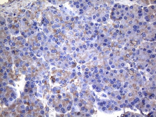 IRF3 Antibody (aa27-169, clone OTI4A1)