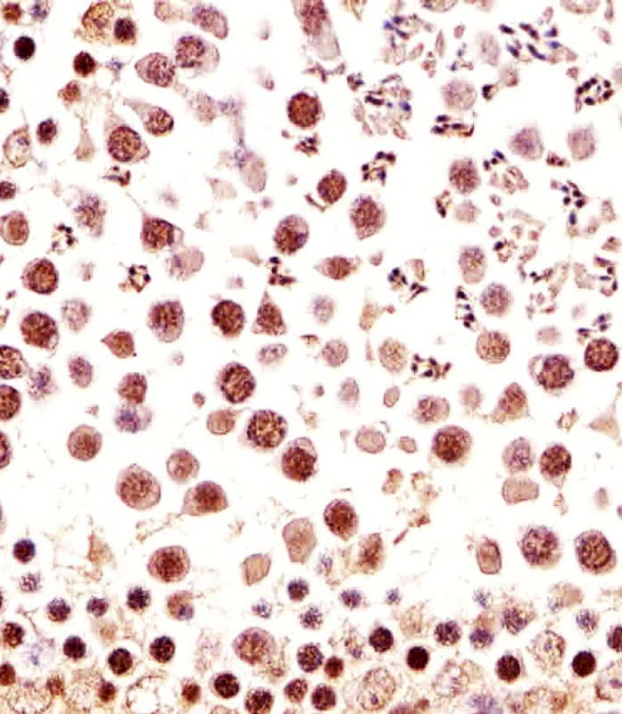 Polyclonal Rabbit anti-Mouse CTR9 Antibody (aa1022-1056, IHC, IF, WB)