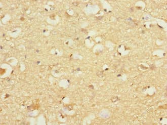 GP1BB / CD42c Antibody
