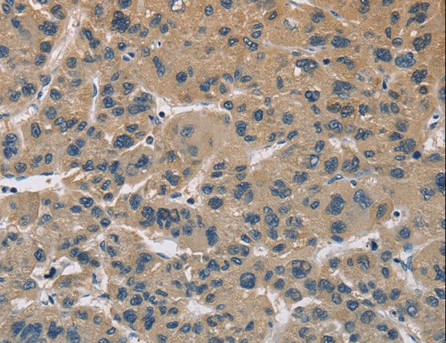 CYR61 Antibody