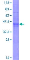 Human CD9 Protein (Recombinant GST)