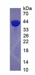 Mouse CTSL / Cathepsin L Protein (Recombinant His-GST)