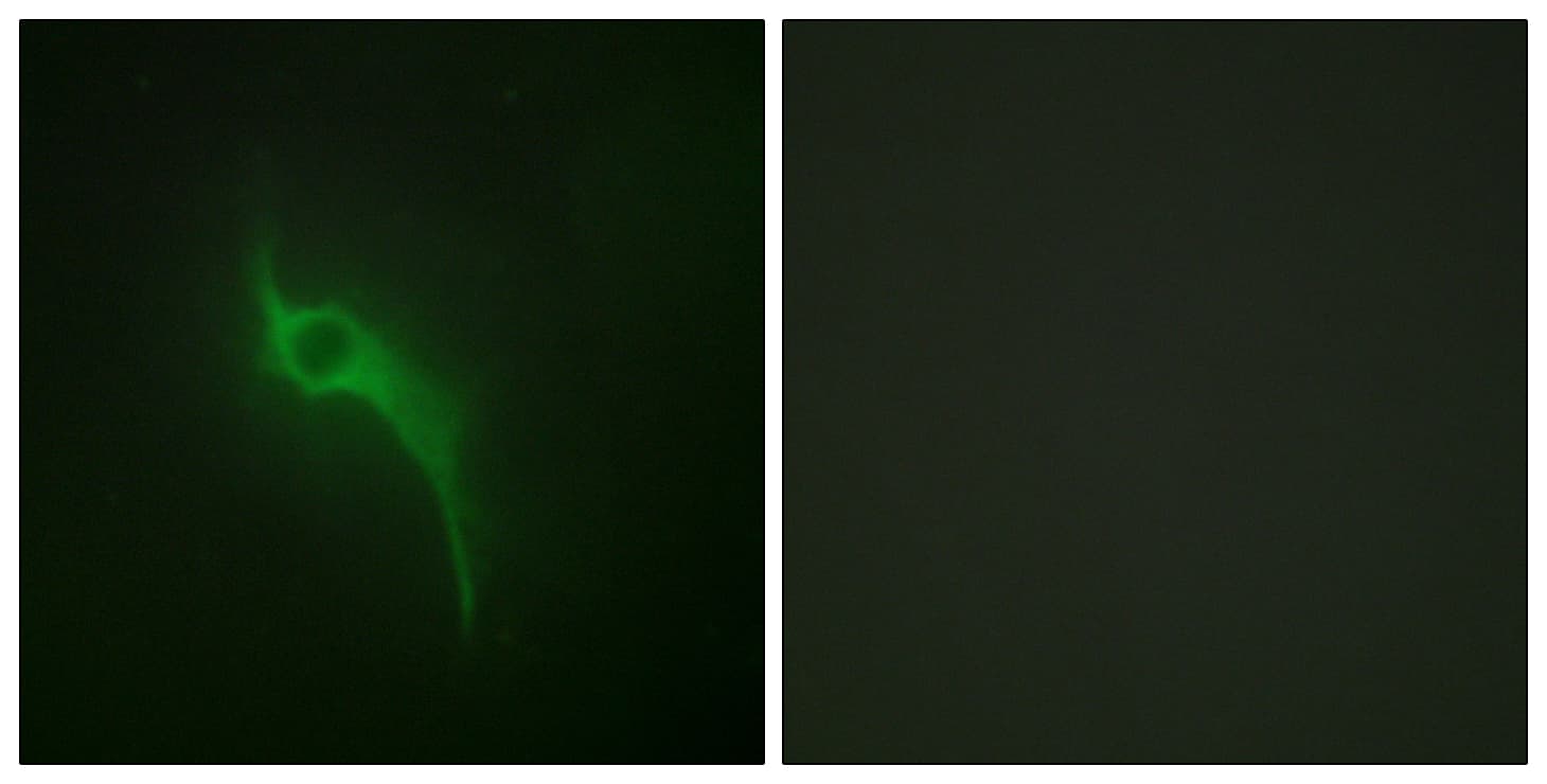 COL5A1 / Collagen V Alpha 1 Antibody (aa301-350)