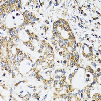 IHC-plus™ Band 4.1 / EPB41 Antibody