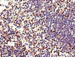 HNE / Neutrophil Elastase Antibody (aa30-267)