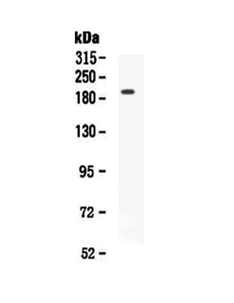 KDR / VEGFR2 / FLK1 Antibody