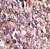 Polyclonal Rabbit anti-Human MAGEC1 Antibody (aa849-880, IHC, WB)
