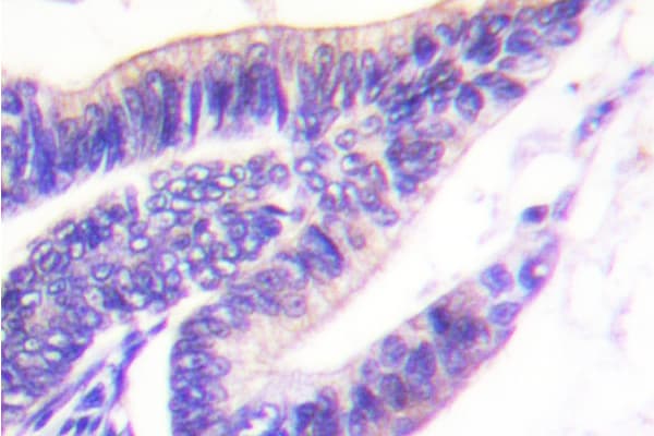 RPS6KB1 / P70S6K / S6K Antibody (Pro412)