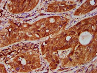 TNFRSF18 / GITR Antibody