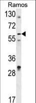 Polyclonal Rabbit anti-Human DCP1B Antibody (aa261-290, WB)