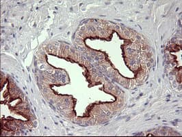 Monoclonal Mouse anti-Human MMP13 Antibody (clone OTI3F5, aa104-471, IHC, WB)