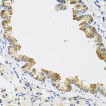 CDKN2C / p18 INK4c Antibody