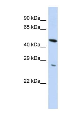 Polyclonal Rabbit anti-Human ZNF655 Antibody (aa115-164, WB)