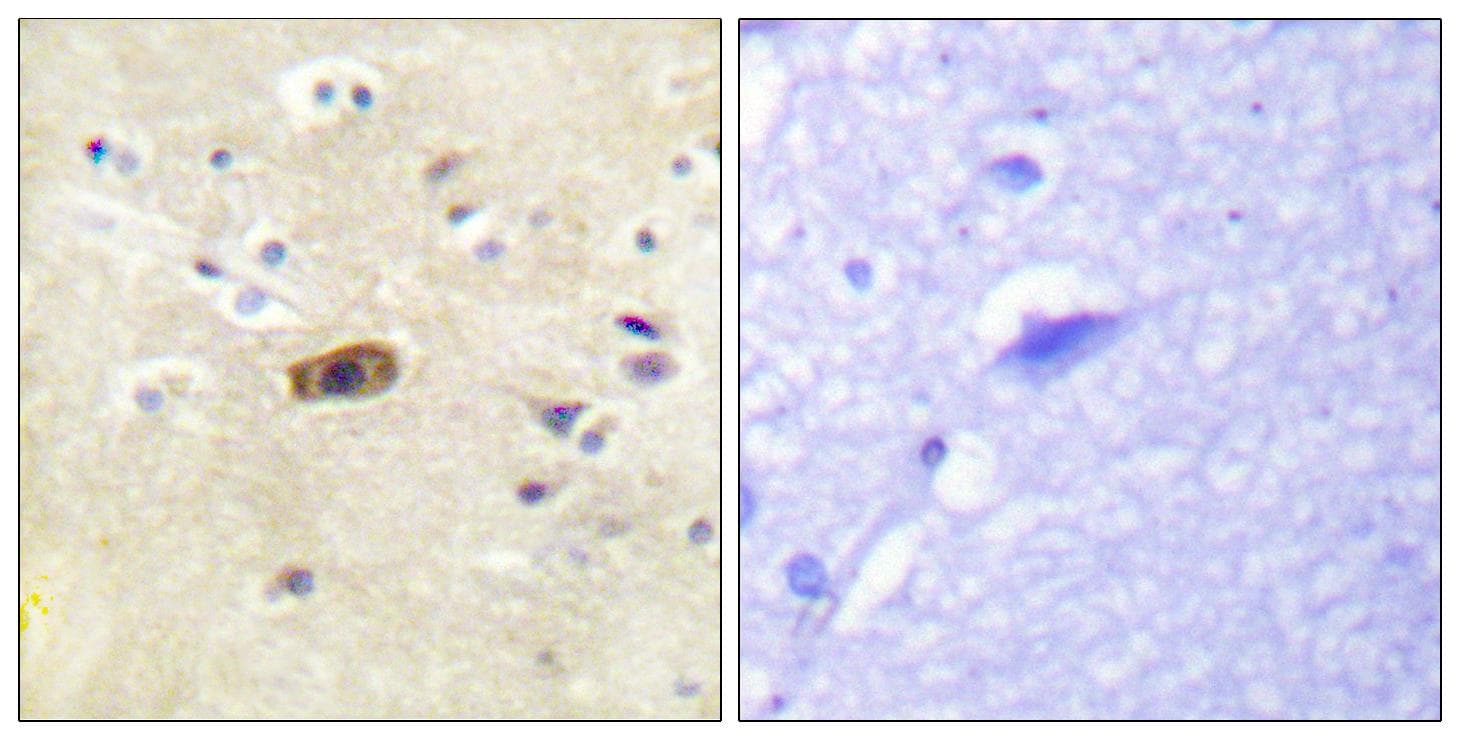 GRIN2A+GRIN2B Antibody (Ab-1246/1252)