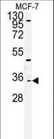 Polyclonal Rabbit anti-Human TTPAL / C20orf121 Antibody (aa204-233, IHC, WB)