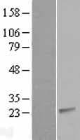 CIB2 / KIP2 Protein (Over-Expression Lysate Myc-DDK (Flag))