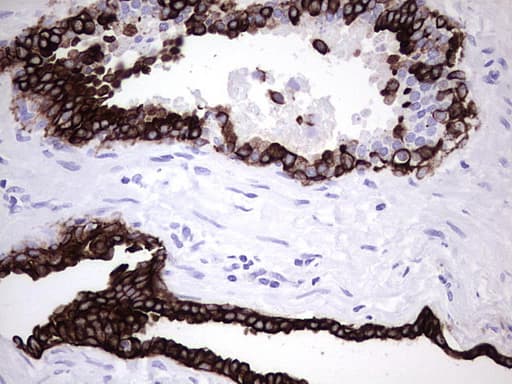 KRT7 / CK7 / Cytokeratin 7 Antibody (aa1-114, clone UMAB161, Carrier-free)