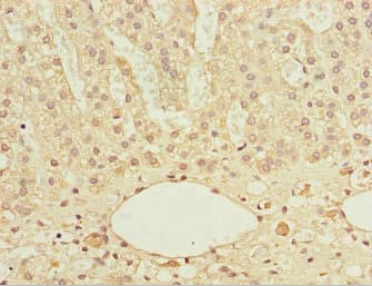 Thymidylate Kinase Antibody