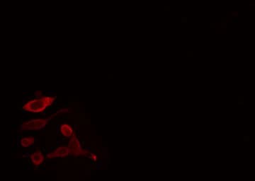CYP2U1 Antibody