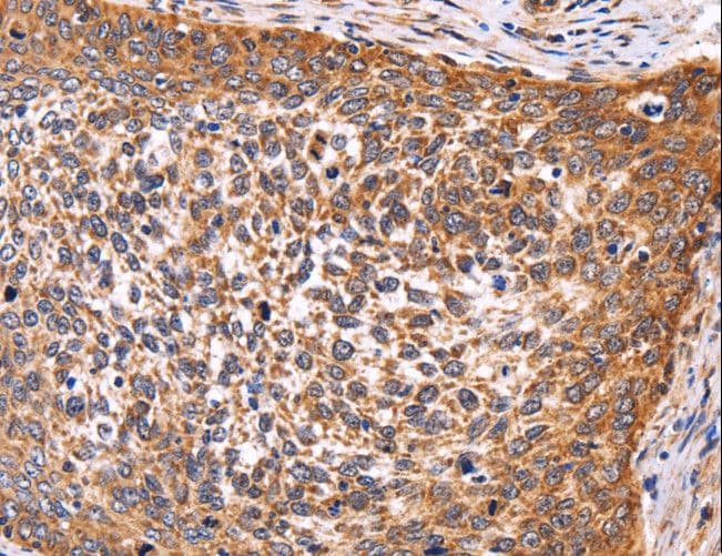 AMIGO2 Antibody