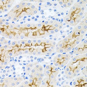 IL17A Antibody