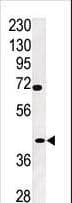 TPST2 Antibody (aa328-358)