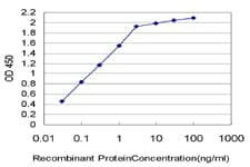 ESM1 / Endocan Antibody (clone 6D4)