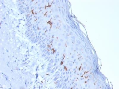 CD1A Antibody (clone rC1A/711, Azide-free, Carrier-free)