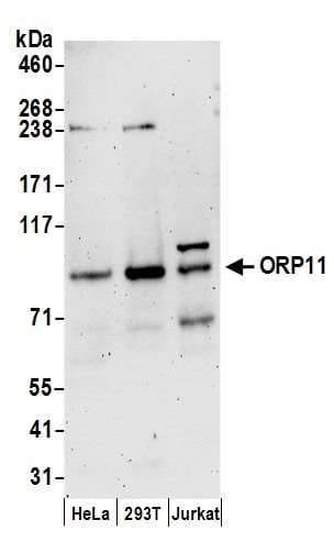 Polyclonal Rabbit anti-Human OSBPL11 Antibody (aa697-747, WB)