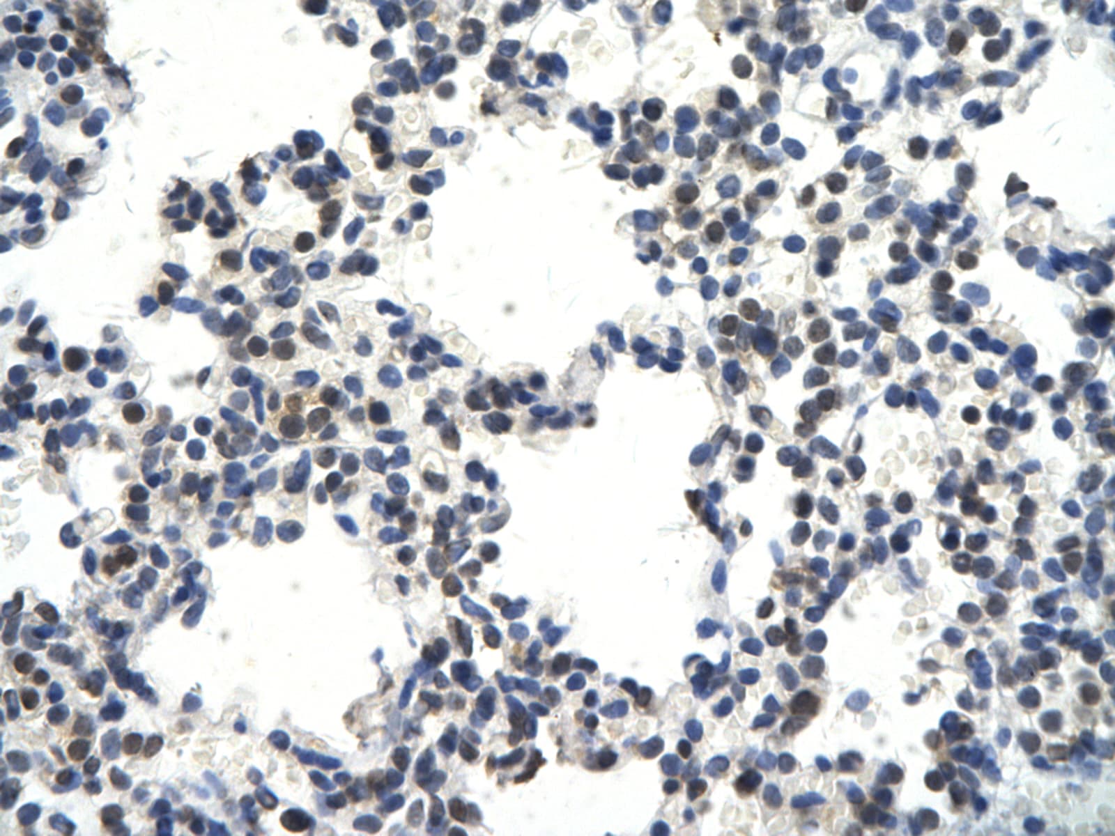 Polyclonal Rabbit anti-Human CRKL Antibody (aa183-232, IHC, WB)