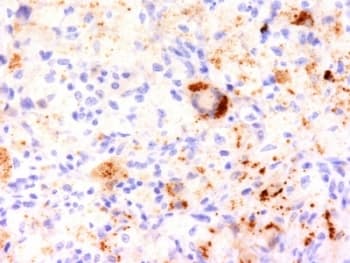 TNF Alpha Antibody (N-Terminus, clone TNF706, Azide-free, BSA-free)