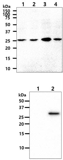 OSTF1 / OSF Antibody (clone AT9G4)