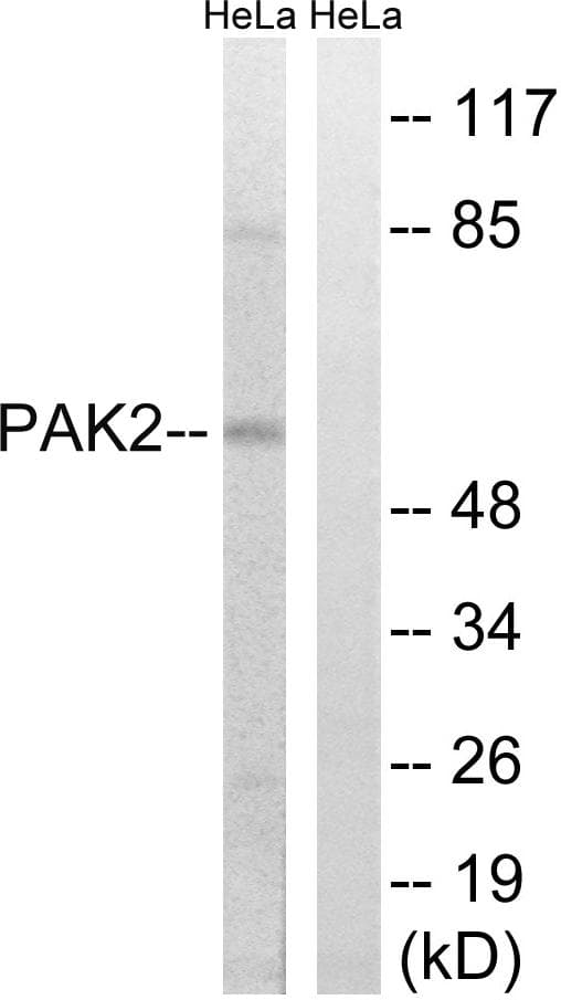PAK2 Antibody (p141)