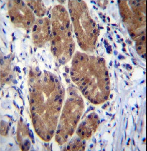 Polyclonal Rabbit anti-Human ZCRB1 Antibody (aa184-212, IHC, WB)