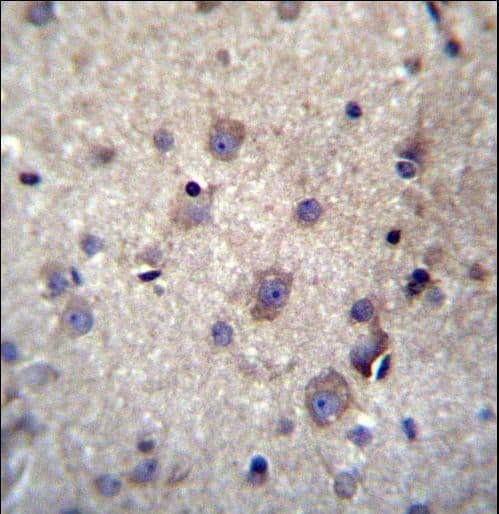 HBQ1 Antibody (aa1-28)