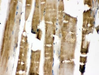 Polyclonal Rabbit anti-Human MAP2K3 / MEK3 / MKK3 Antibody (IHC, WB)