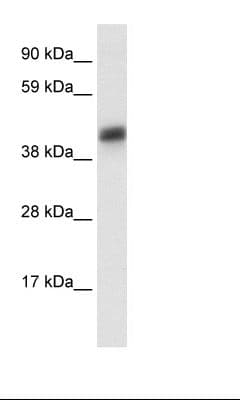 ASGR1 / ASGPR Antibody (aa100-149)