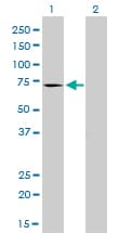 MTM1 / Myotubularin Antibody (clone 1C10)