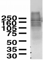 MNK / ATP7A Antibody (clone S60-4)