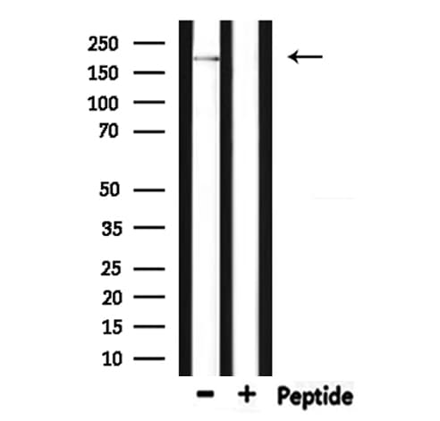 DOCK7 Antibody