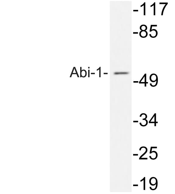 Polyclonal Rabbit anti-Human ABI1 / SSH3BP1 Antibody (aa152-201, WB)