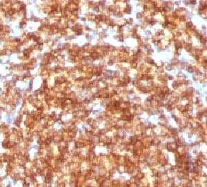 CD45RB Antibody (clone CDLA45RB-1)