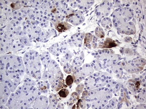 Monoclonal Mouse anti-Human CEACAM5 / CD66e Antibody (clone OTI3D8, aa35-680, IHC, WB)