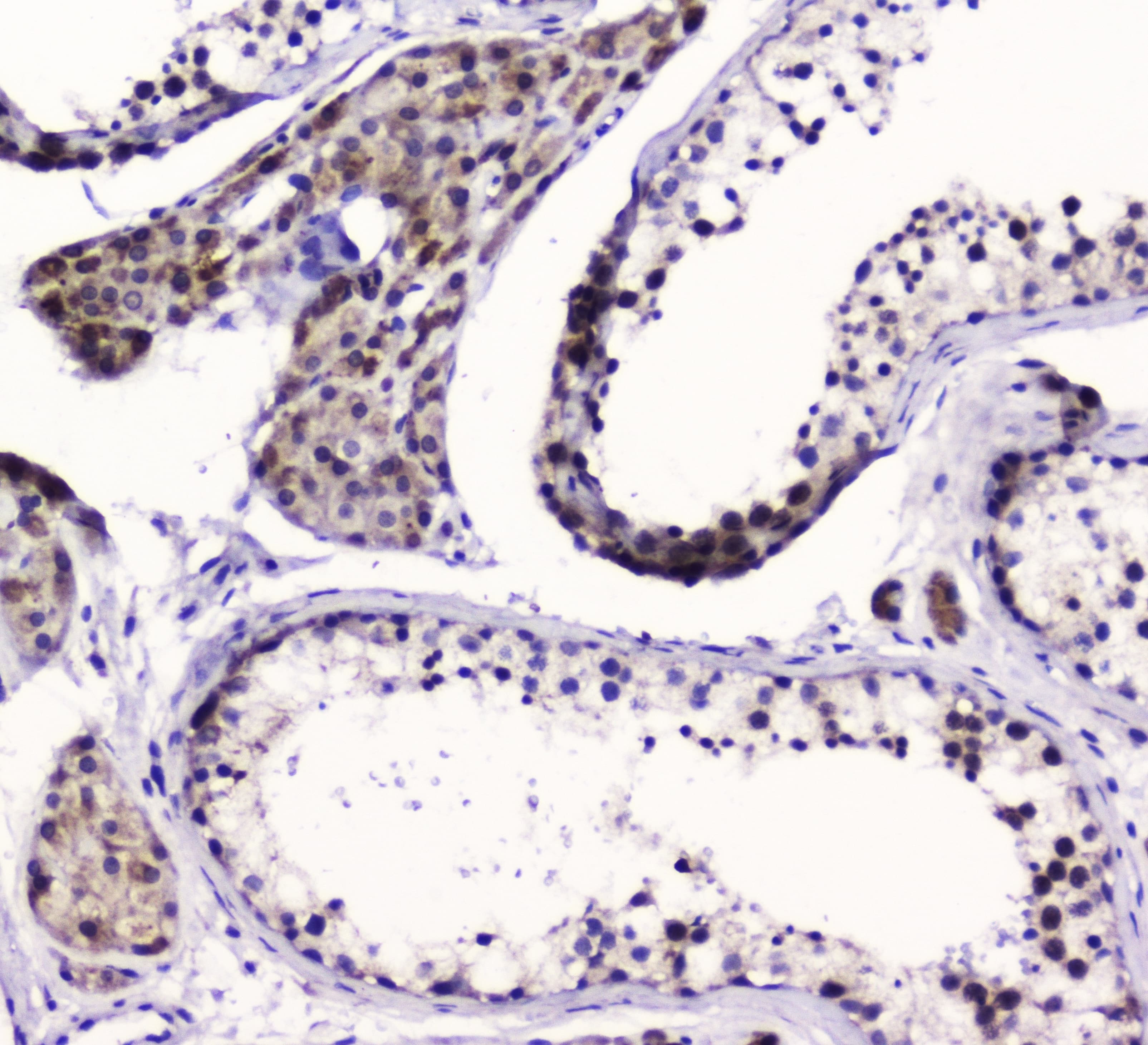 Polyclonal Rabbit anti-Human SMC6 Antibody (WB)
