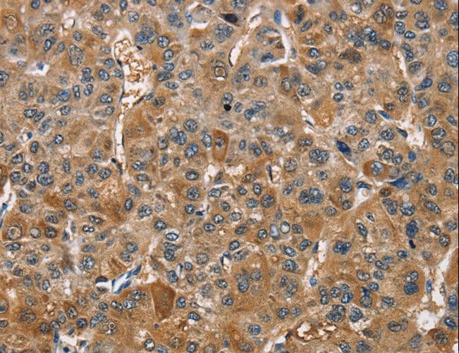 TRIP4 / ASC-1 Antibody
