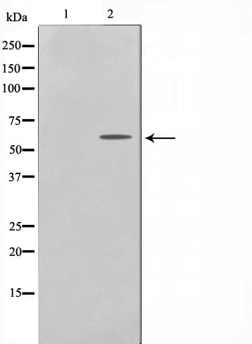 Polyclonal Rabbit anti-Human UBXN11 / SOC Antibody (IHC, IF, WB)